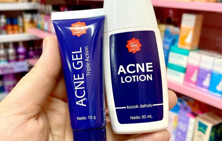 Perbedaan Viva Acne Gel dan Lotion, bagus mana